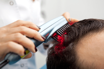 Low-Level Laser Hair Therapy for Hair Loss